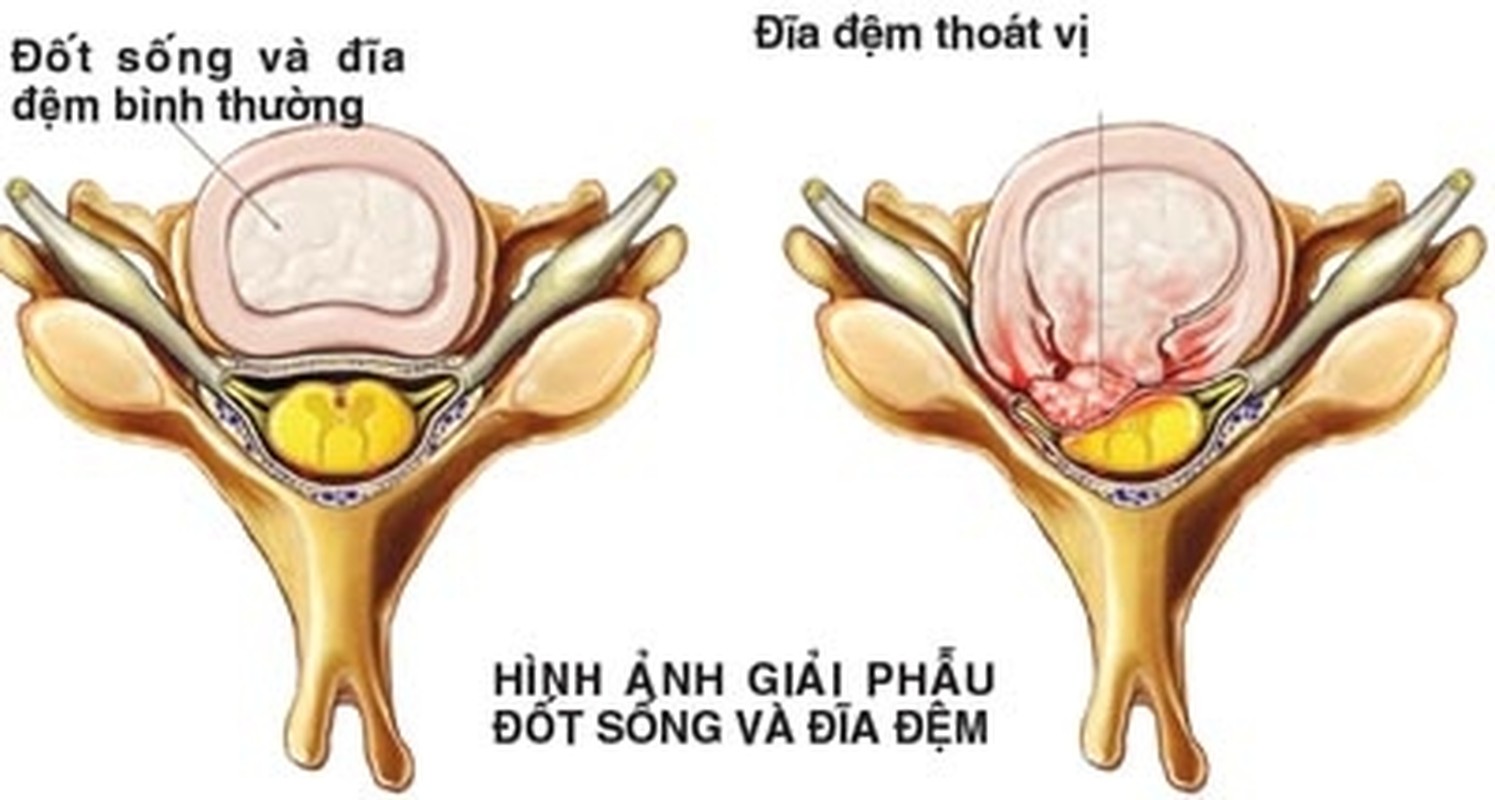 Can benh của nguòi mau Thai Ha co the gay tan phe-Hinh-7